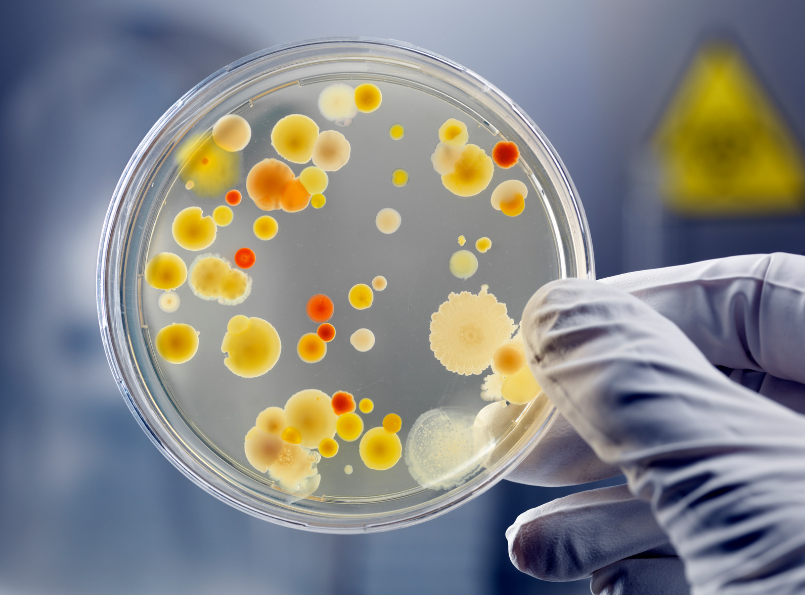 Diverse Bakterienkulturen in einer Petrischale, einige davon möglicherweise resistent.